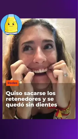 los retenedores hace magia 