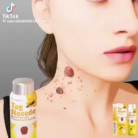 Adiós verrugas, lunares y manchas Con solo unas aplicaciones al día 😱 🐝 El poder del veneno de abeja en tu piel.