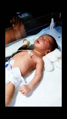 RÉANIMATION EN NÉONATALOGIE. #bebe #sante #reanimation #medecine #fyp #pourtoi #doctor #nurse #pediatria #neonatologia 