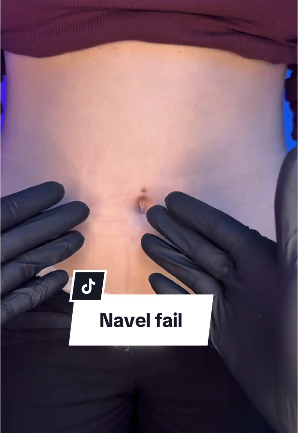 Navel fail  #piercing #piercingfail #navelpiercing 