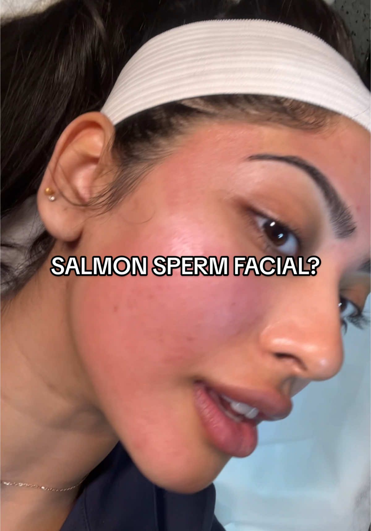 Soo I got Salmon Sperm in my face! @Skincentrix and I’m so surprised at the results ! Would u do this? 