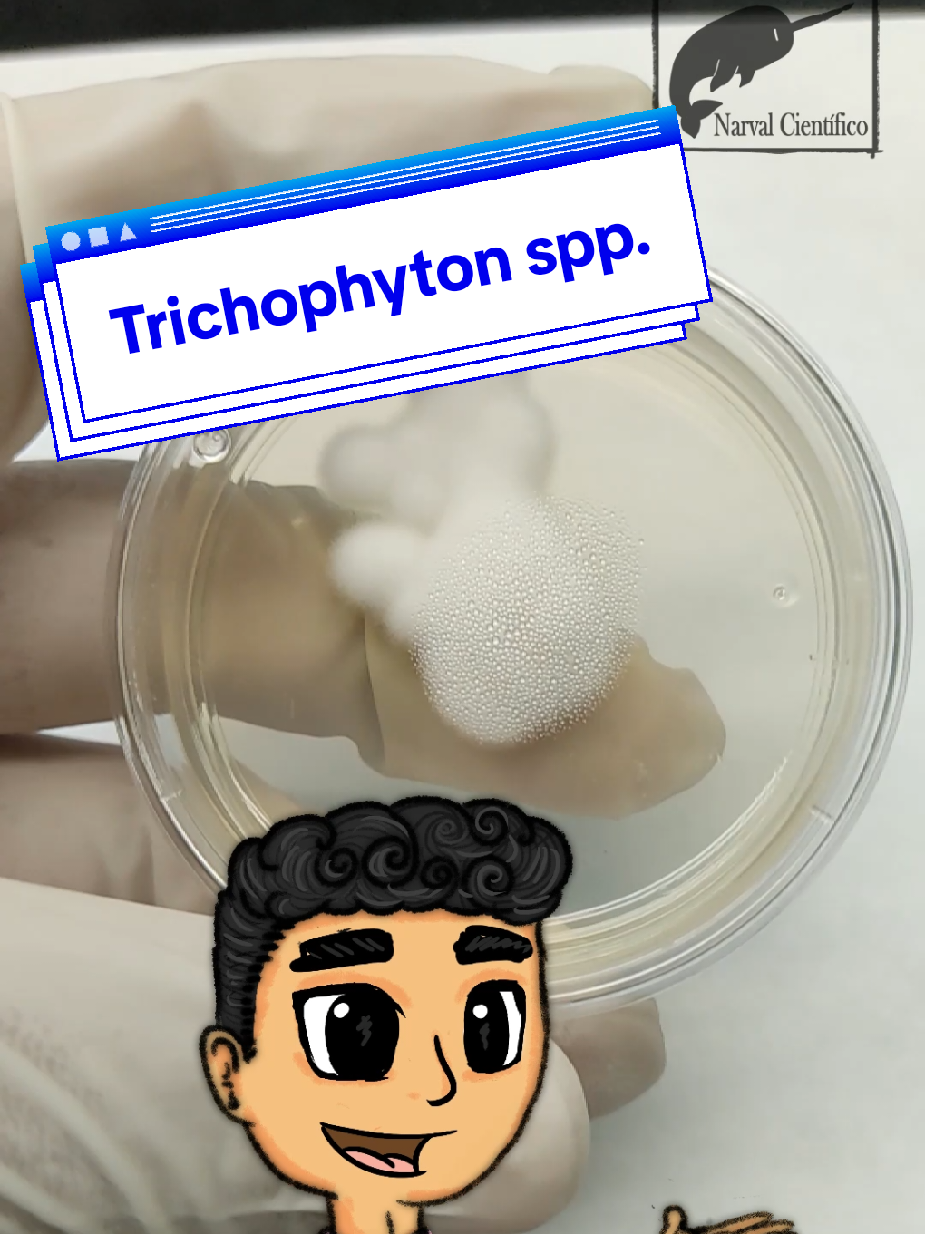 Hoy les comparto este video hablando sobre Trichophyton spp. espero les guste 🤓🔬 #trichophyton #hongos #micologia #microbiologia #laboratorio #enseñar #quimicofarmacobiologo #qfb #tesis #cienciaentiktok #narvalcientifico #humor #fypp #hongo 