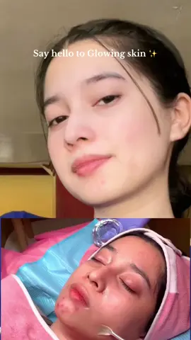 Invest in your skin 9 young babies! ✨  #9youngbasic #glutathione #youthfulskin 