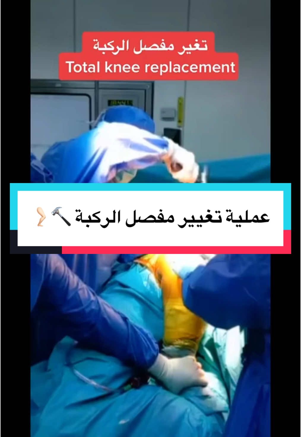 #الدكتور_أمين_إبراهيم_أبوسعدى #الدكتور_أمين_أبوسعدى #الأردن #السعودية #العراق #اليمن #ليبيا #فلسطين #تغيير_مفصل_الركبة #احتكاك_المفاصل  