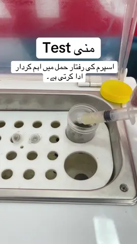 اسپرم کی رفتار حمل میں اہم کردار ادا کرتی ہے۔ #semenanalysis #medicaladvice #foryouu #tiktokviral #nursingschool #laboratory #fertility #fertilitytreatment #MLTWorld 