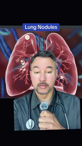 #medical #doctor #lung #lungcancer #greenscreen 