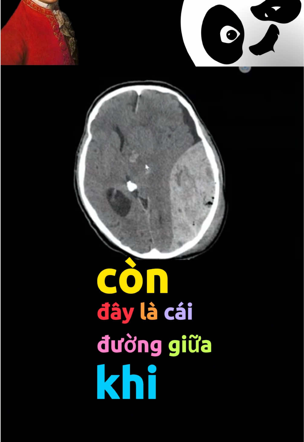 Thảo luận tiếp về CT sọ não cùng cô Linh nha #hocycogivui👩🏻‍⚕️💙 #sinhvienyduoc #faquiz #trending #faclass #ct 