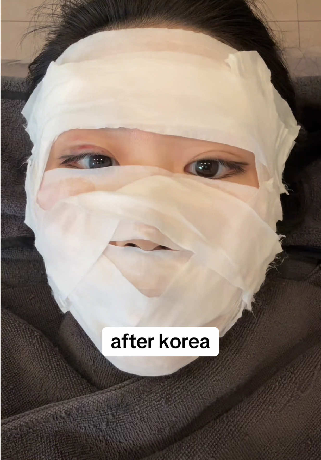 glow up in koreaaa ✨✨✨ #seoul #korea #GlowUp #skinclinic #skincare #kbeauty #des #doubleeyelidsurgery 
