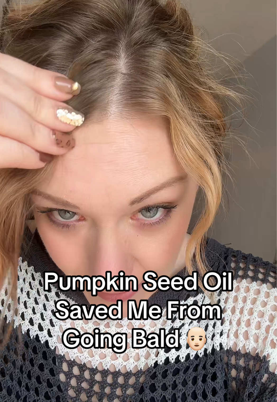 Replying to @Sarah.smile77 Definitely take before and after pictures! Pumpkin seed oil has completely transformed my hair when I thought I was going to lose all of it completely!  #microingredients #pumpkinseedoil #hairshedding #hairthinning #hairthinningsolution #hairlossjourney #hairtreatment #hairtreatments #tiktokshoprestock #ttslevelup #tiktokshopcreatorpicks  *Results vary 