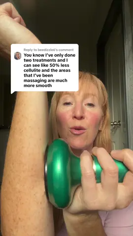 Replying to @beedizzle6 that is amazing!!! Thank you for sharing this!🤩 #cupping #cuppingtherapy #cuppingtherapy #cellulite 