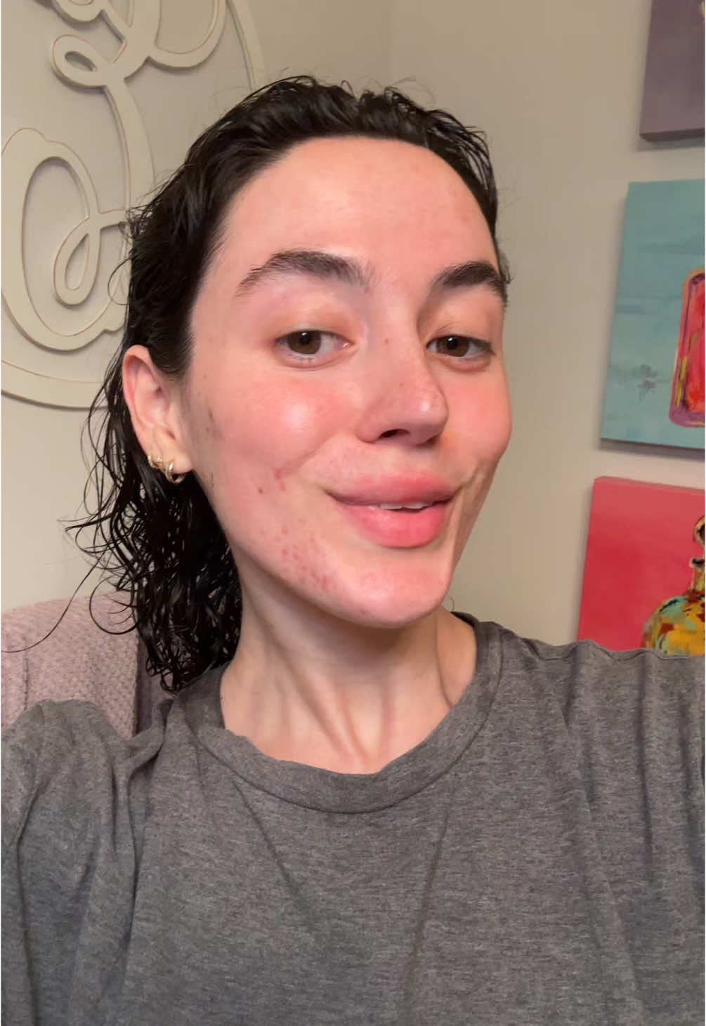 My week 7 spirolactone update ⭐️ #acne #acneproneskin #spironolactone #cysticacne #hormonalacne #acnejourney #skinjourney 