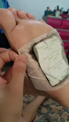 Kinoki foot patch Japanese foot patch #footpatch  #footpatchdetox  #kinokidetox  #kinoki  #kinokidetoxfootpads 