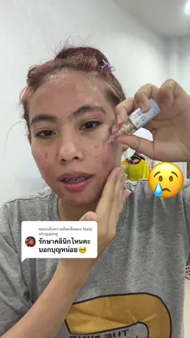 ตอบกลับ @Natji shopping #ซีแค๊ดหน้าติดสาร #ซีแค๊ด #ครีมก้งคน101 #ครีมพี่ก้งสูตรฝ้า #เซรั่มก้ง #เซรั่มดีพลัส #ครีมดีพลัสสกิน  