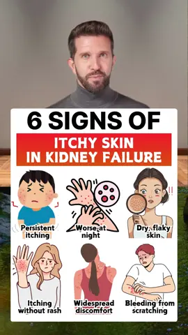 6 signs of itchy skin in kidney failure #healthy #healthcare #healthtips #kidney #kidneyfailure #kidneydisease #itchyskin #itchy 