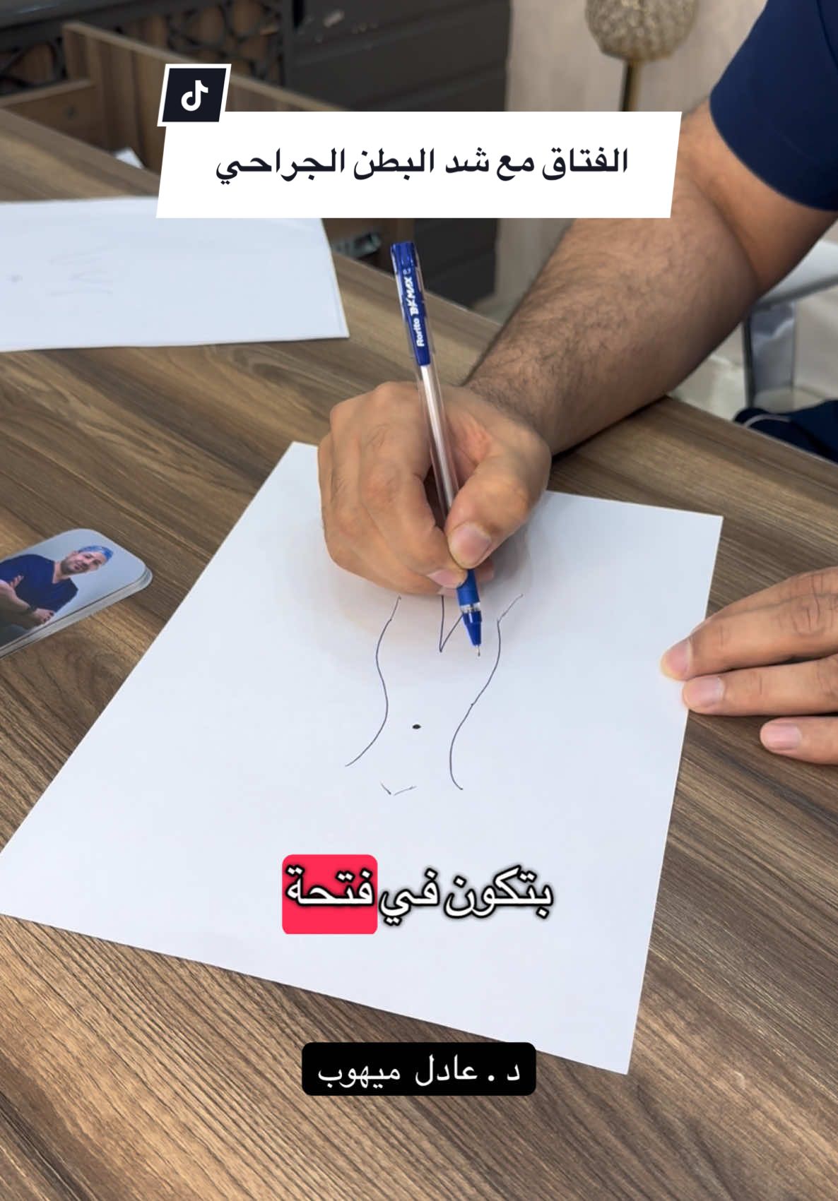 #الفتاق مع #الشد_الجراحي  لدكتور #عادل_ميهوب واتس المنسقه : 0554449760 #عيادة_تجميل #مزدانه_الصحافه #اكسبلورexplore #الرياض #fyp #تجميل #شد_البطن #فتق #نحت_الجسم #نحت_الخصر 