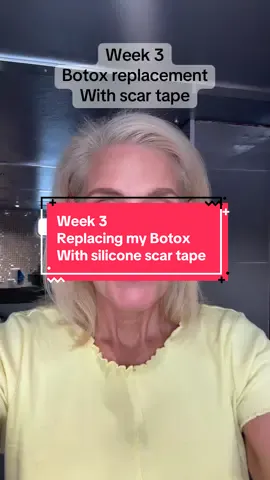 #botox #skincare #beforeandafter #siliconescartape #siliconescarsheets #beautyhacks 