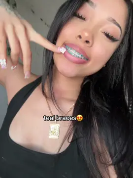 luv my braces