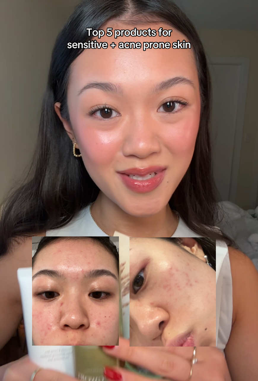fav skincare for acne prone and sensitive skin ✨  @anua_global @imfrom_us @PURITO SEOUL @La Roche-Posay  #acneprone #clearskin #sensitiveskin #anuapartner 