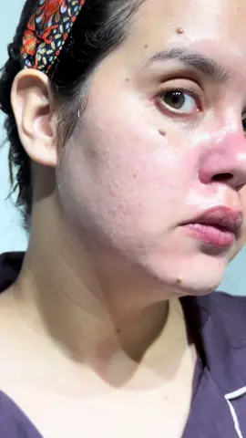 Test du nouveau Shot Mucin de @cleardea  Texture légère, absorption rapide et glow assuré. Un must pour une peau rebondie et hydratée ! #cleardea #koreanskincare #kbeauty #collagen #glassskin #glowyskin