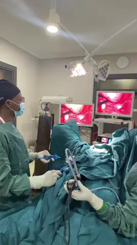FIBROID REMOVAL. This is a Laparascopic Myomectomy. Patient selection is important during this procedure, not all fibroids can be removed by laparoscopy, similar way as not all fibroids benefit from Embolisation. Deciding the best therapy for each client helps save costs and repeated surgeries.#fypシ゚viral #laparascopicsurgery #ugandatiktok🇺🇬 #healthy #fyp 