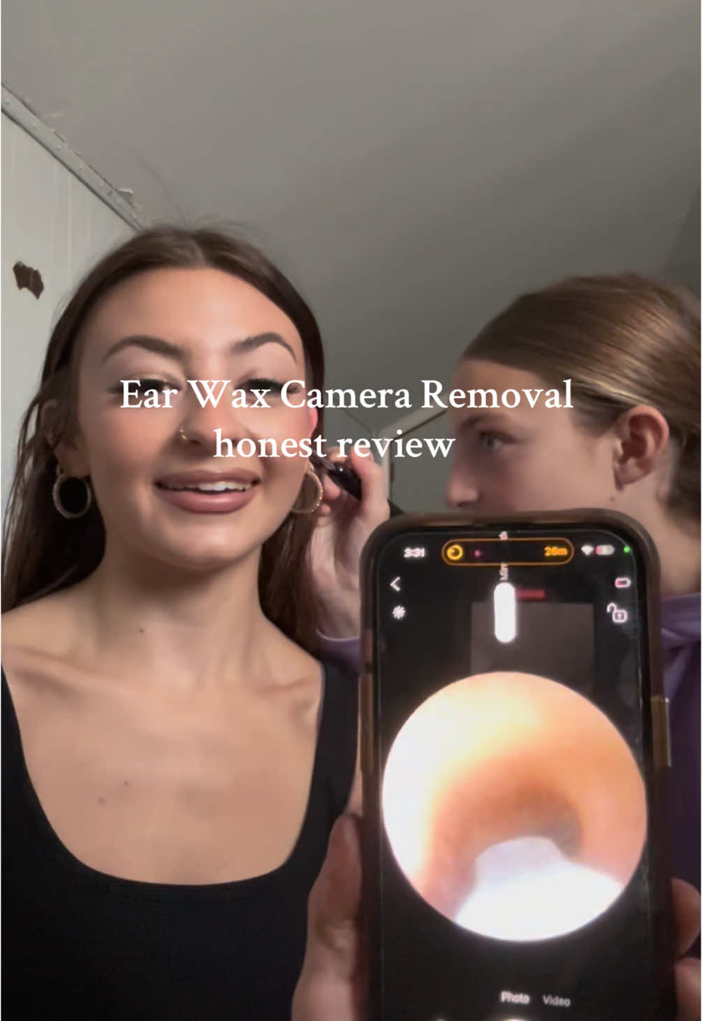 WARNING THIS IS GROSS⚠️ I’m telling y’all BUY IT it’s so WORTH IT Q-Tips aren’t doing shitt‼️ #earwaxremoval #earwax #earwaxremovalvideos #earwaxremmoval 
