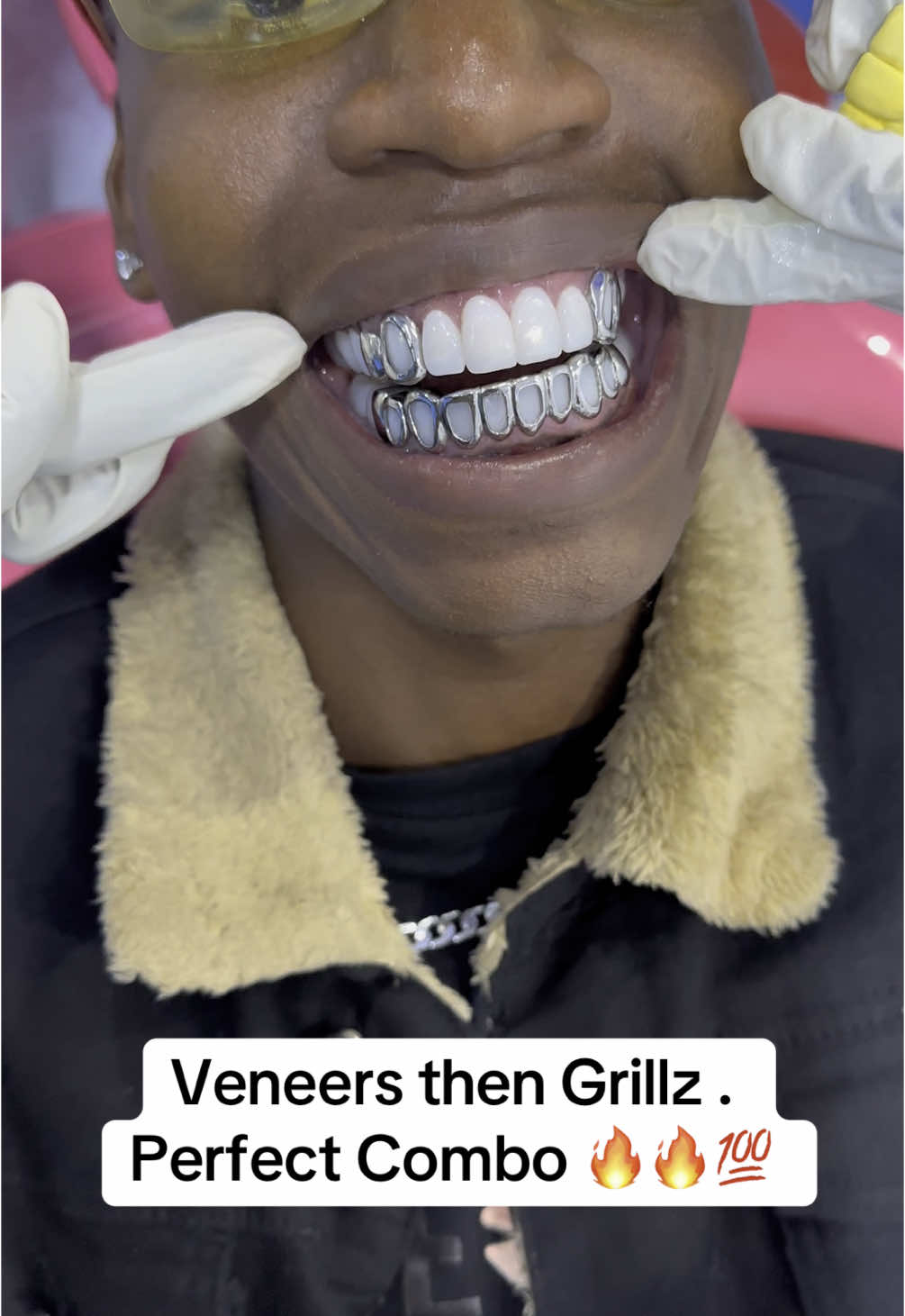 First Veneers then grillz set on top🔥 You all have never seen this before. The first case in Africa 💯 #grillz #grill #elitedentalstudio #cosmetics #fashion #dentist #teeth #fyp #creatorsearchinsights 