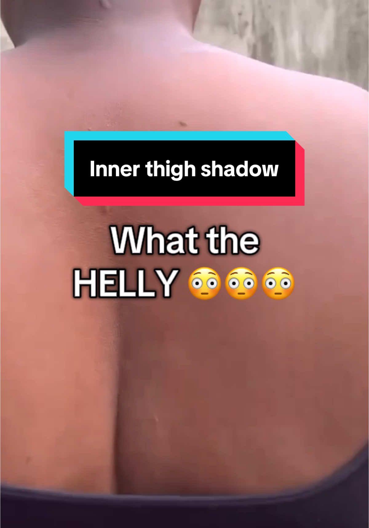 That’s a nice shadow you got there bookie. Let’s fix it 🫶🏽☺️ #fyp #darkspots #fypシ #trending #viral 