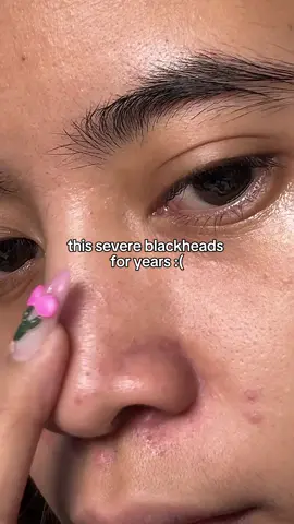 this G2G volcano claystick is 🤯!!!  #claystick #claymask #g2gvolcanoclaystick #g2gph 