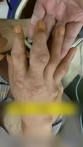 omega3 - meningkatkan imuniti - meremajakan kulit