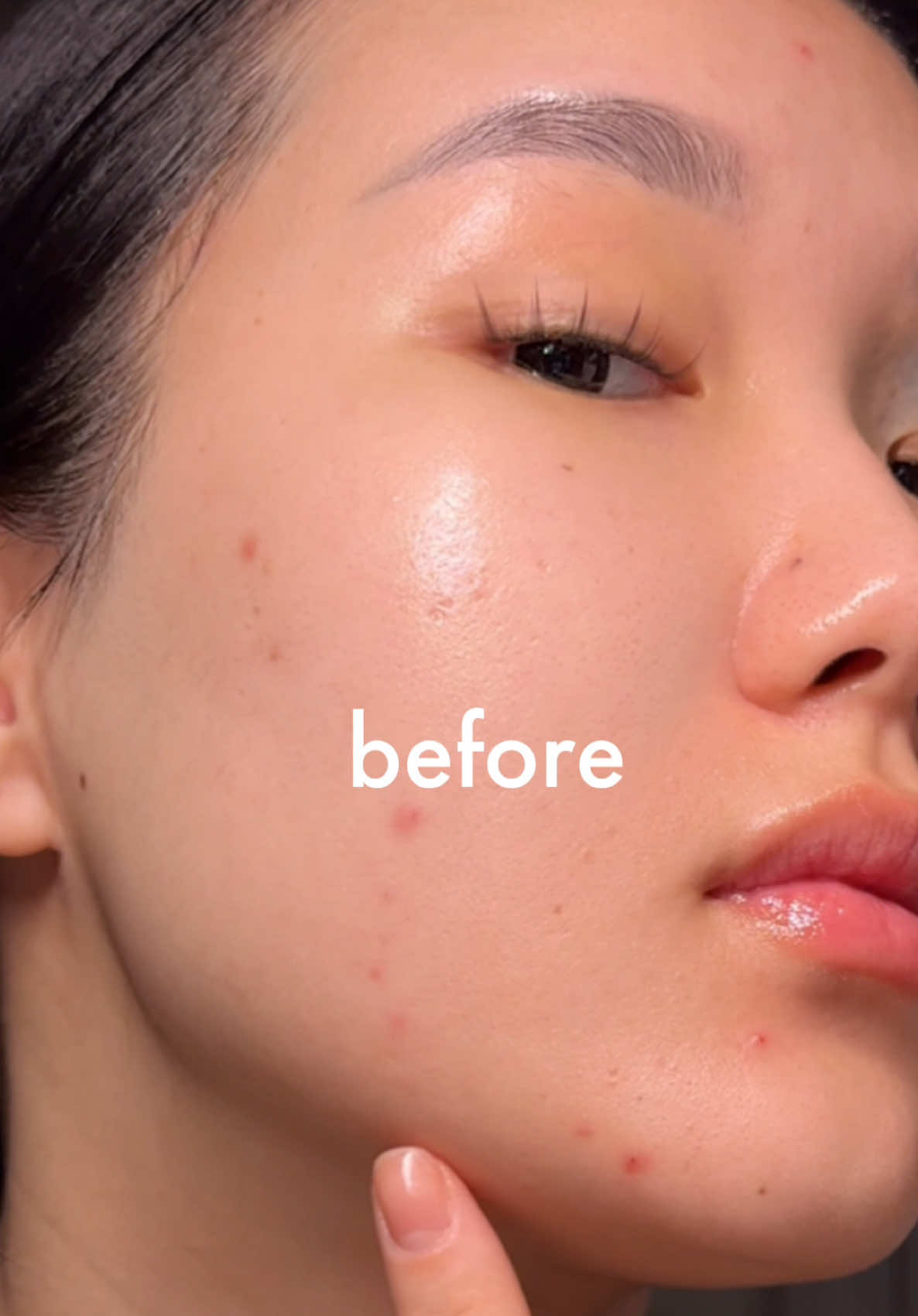 😮‍💨😮‍💨😮‍💨 @KSECRET GLOBAL  #уходзакожей #ретиналь #koreanskincare #kbeauty #skincare #корейскаякосметика #акне #ksecretretinalserum #ksecretseoul1988 