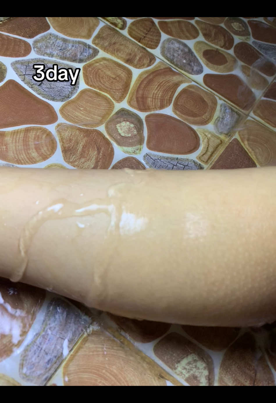 the result☠️#philippines #kojiesansoap #foryou #ဒီတစ်ပုဒ်တော့fypပေါ်ရောက်ချင်တယ် #ကျားမမရွေးသုံးလို့ရပါတယ် #fypdong #အသားဖြူဆပ်ပြာ #အတုအစစ်သတိပြုပါ #CapCut #နာမည်ကြီးနေတာလေး #vewis #fypシ゚ #fypage #fyp #သုံးဖူးသူတိုင်းရဲ့အသဲစွဲလေး #fyppppppppppppppppppppppp #foryou #ဒီတစ်ပုဒ်တော့fypပေါ်ရောက်ချင်တယ် 