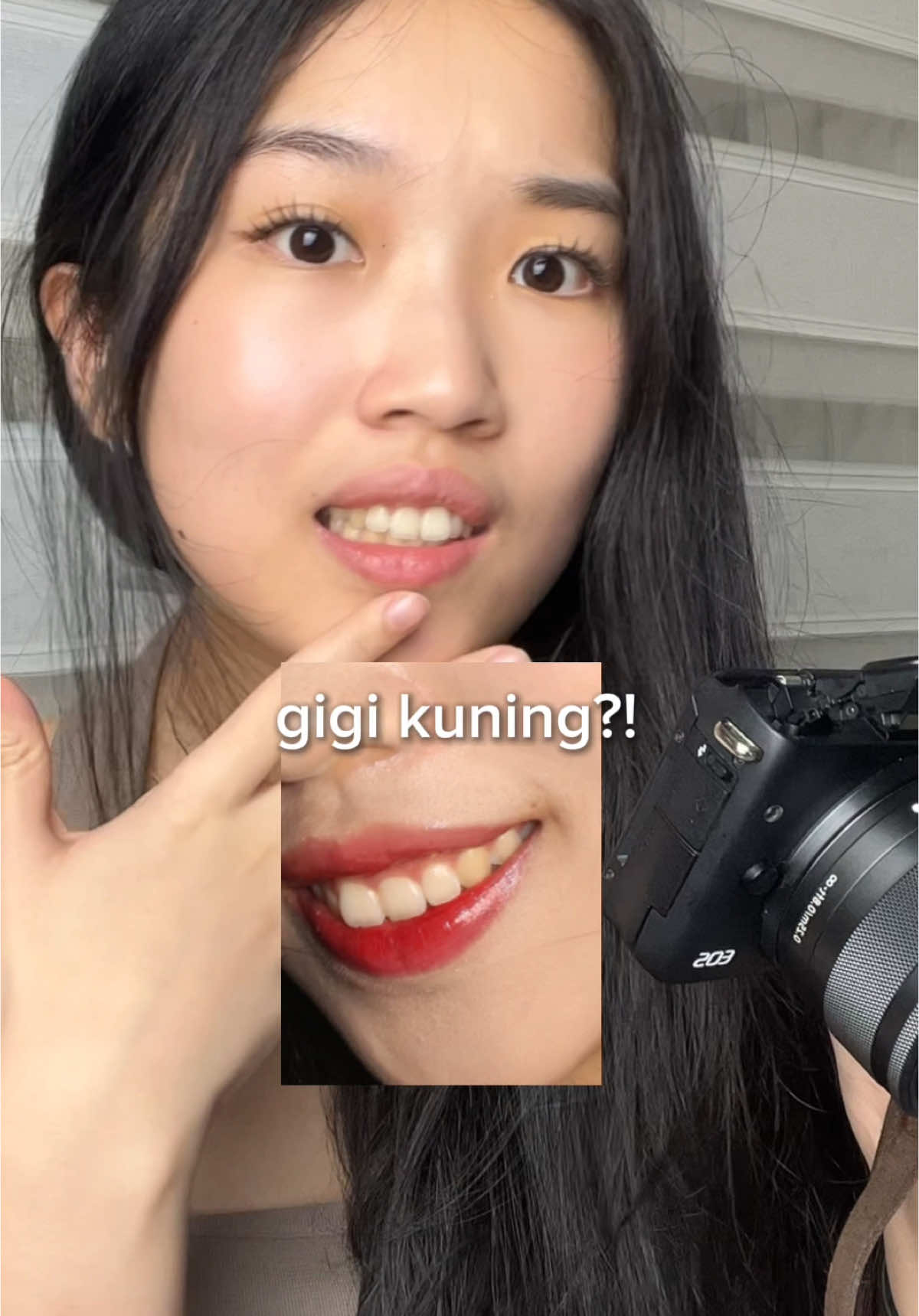 INSEKYUR BANGET LIAT GIGI KUNING🦷🙇🏻‍♀️ sampe nemuin odol ungu ini Olaif Purple Whitening Toothpaste🪥 #yellowteeth #pastagigi #semuabisaditiktok @Olaif Dental 