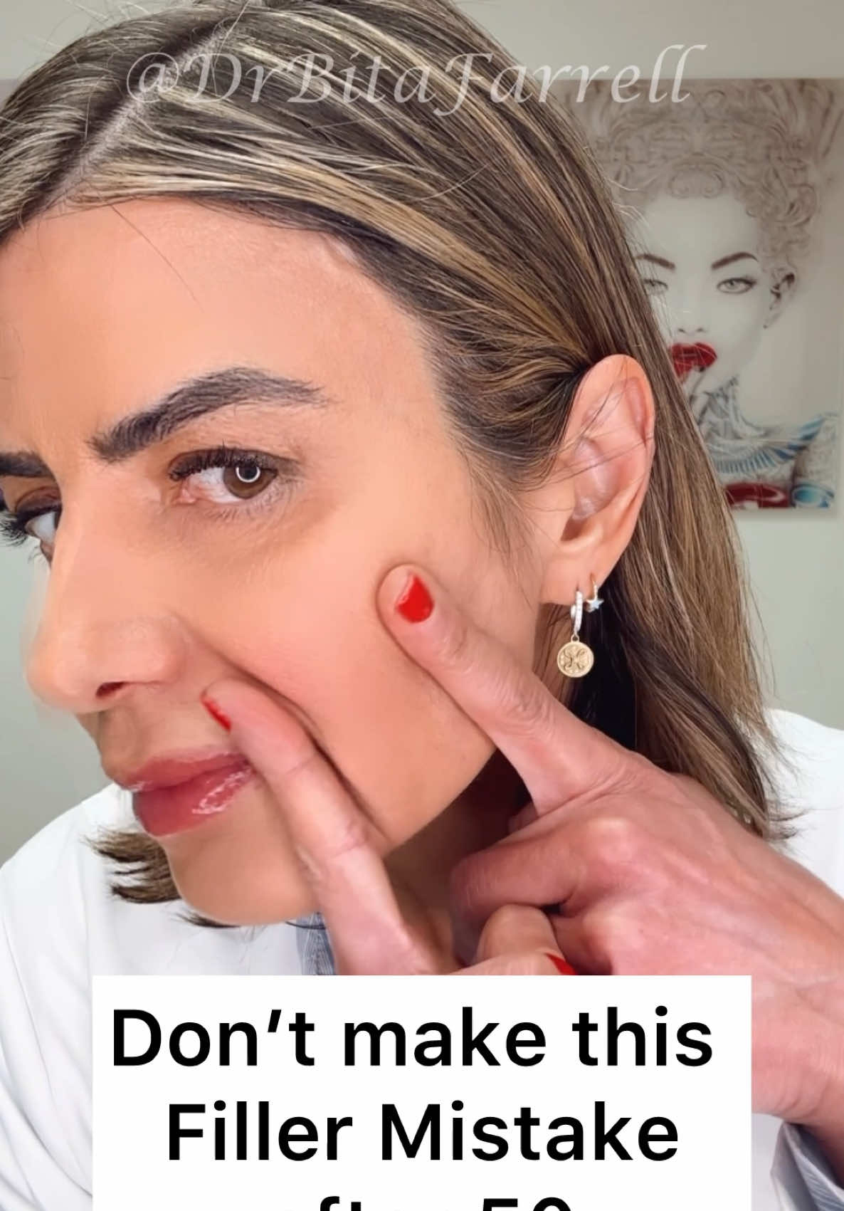 Biostimulators offer a natural approach to facial rejuvenation by working with your body to make more collagen and elastin. Unlike traditional hyaluronic acid fillers that provide immediate volume through gel placement, biostimulators such as Radiesse (calcium hydroxylapatite) and Sculptra (poly-L-lactic acid) activate the skin’s fibroblasts, triggering collagen production over time.   This means: 🔬 Gradual improvement in volume and skin thickness 🔬 Restoration of youthful contours through endogenous collagen production 🔬 Long-term structural support — not just temporary filling Results evolve subtly over weeks to months, creating a refreshed, lifted appearance that looks entirely natural. No overfilled look. No puffiness. Just a progressive enhancement of your own facial architecture. The most elegant and natural results come from treatments that stimulate your collagen and elastin. #Biostimulators #CollagenInduction #FacialRejuvenation #Sculptra #Radiesse #drbitafarrell #naturalaestheticscenter 