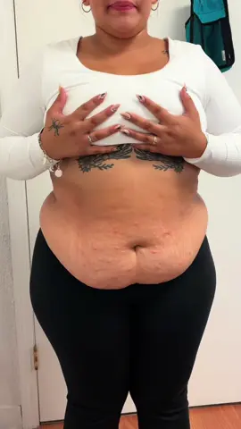 A few months of body sculpting results.  When I first started I was only going once a month then started twice a month and now I go once a week.  I’m in the gym daily, drink my water, and it’s been about 3 months that I’ve been eating in a calorie deficit now. Body sculpting just adds to all my progress, helps reduce inflammation, and smooths out my cellulite. I can’t wait to see what a few more months of consistency does.  (The brown leggings I wore today are tighter than the black ones I had on when I first started.)  #bodysculpting#fyp#midsizegal#motivation 