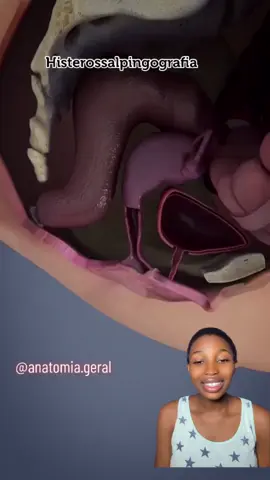 HSG procedures…what was your experience like??