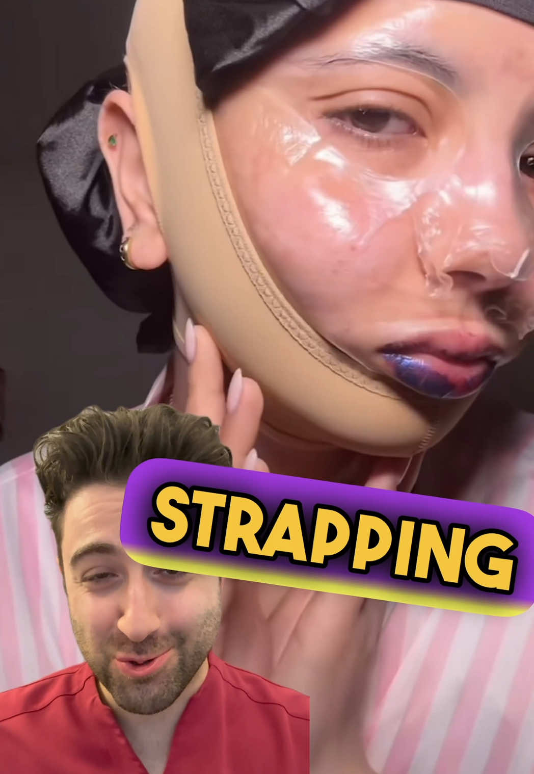 What are your thoughts on the forceful chin strap, have you ever attempted it overnight? #jawline #chinstrap #TMJ #dentistry #jaw #beauty #beautycommunity #beautyguru #skincare #skincareaddict 