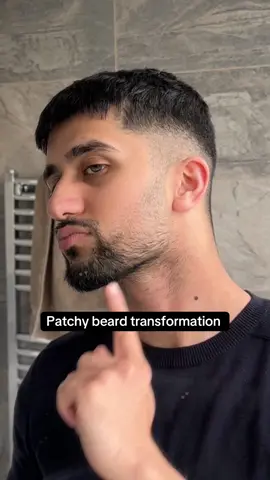 Patchy beard? Not anymore #beard #patchybeard #fyp 