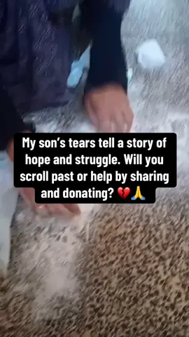 My son’s tears tell a story of hope and struggle. Will you scroll past or help by sharing and donating? 💔🙏 