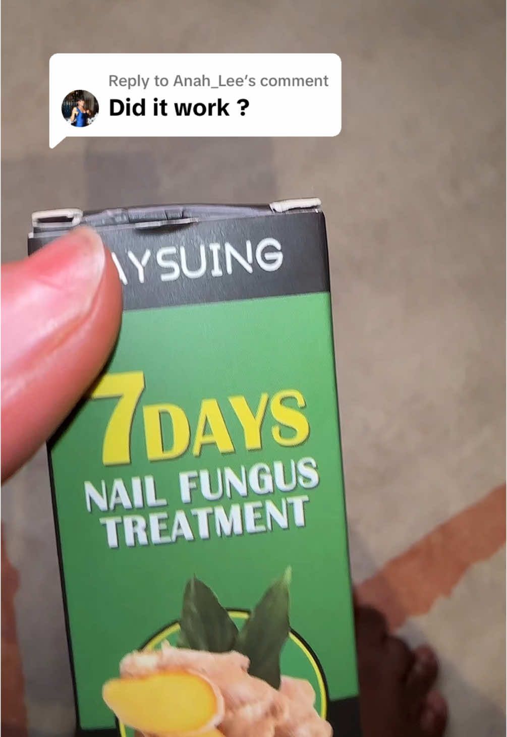Replying to @Anah_Lee yes it worked for me #nailfungus #fungus #nails #nailtreatment #nailcare #pedicure #pedicurekit 