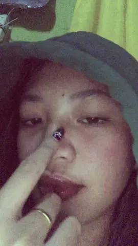KUPAL
