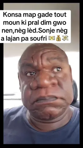 #bignose#challengeaccepted#foryouu#azoukenkeng