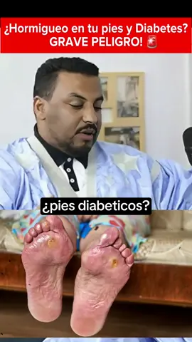 #diabeti #resul #diabetesawareness #diabetes 
