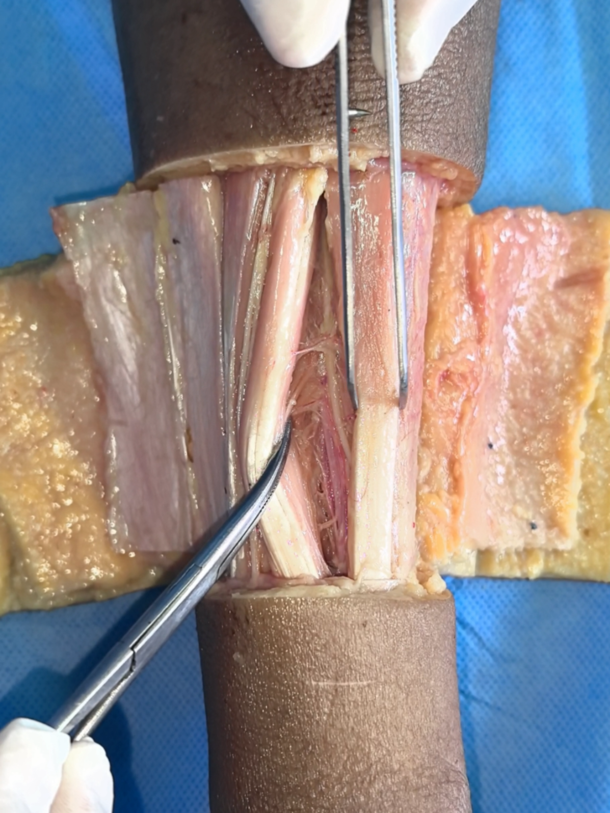 Disección del compartimento anterior de la pierna.  #fyp #foryou #viral #anatomía #anatomy #disecction #disección #cusco #perú #UNSAAC #morfhology  #medicina #medicine #EstudianteDeMedicina #medstudent #nomenclatura #músculos #nervios #arterias #arteries #Perú #Peruvian 