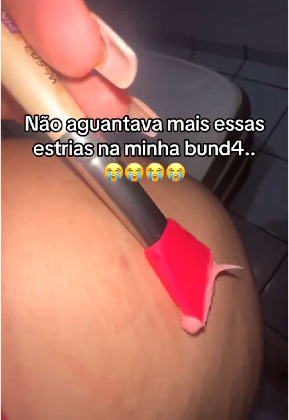 Adeus estrias🥹  #estriasbrancas #tratamentoemcasa #mulher #e #cuidadocomapele #cuidadocomapele #dicasdebeleza #