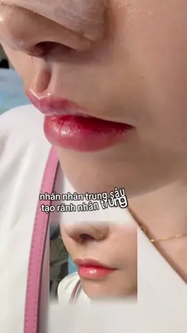 #riwiewlamdep #taoranhnhantrung #nhấnnhântrung #làmđep #thammy #tuvanthammy #chiasekinhnghiem #hottrend #xuhuong #tiktok 