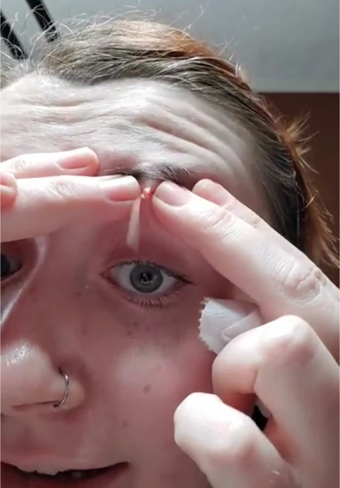 I was panicking too, OMG! 😂😮 - Unknown creator! - #cyst #eyebrows #pop #viralvideos #pimples #foryoupagе #pimplepop #fyp 