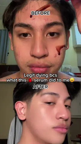 #skintificserum #SkintificSerum #PeelingSerum #Tigyawat #exfoliating #ahabha #bloodserum  @SKINTIFICPH 