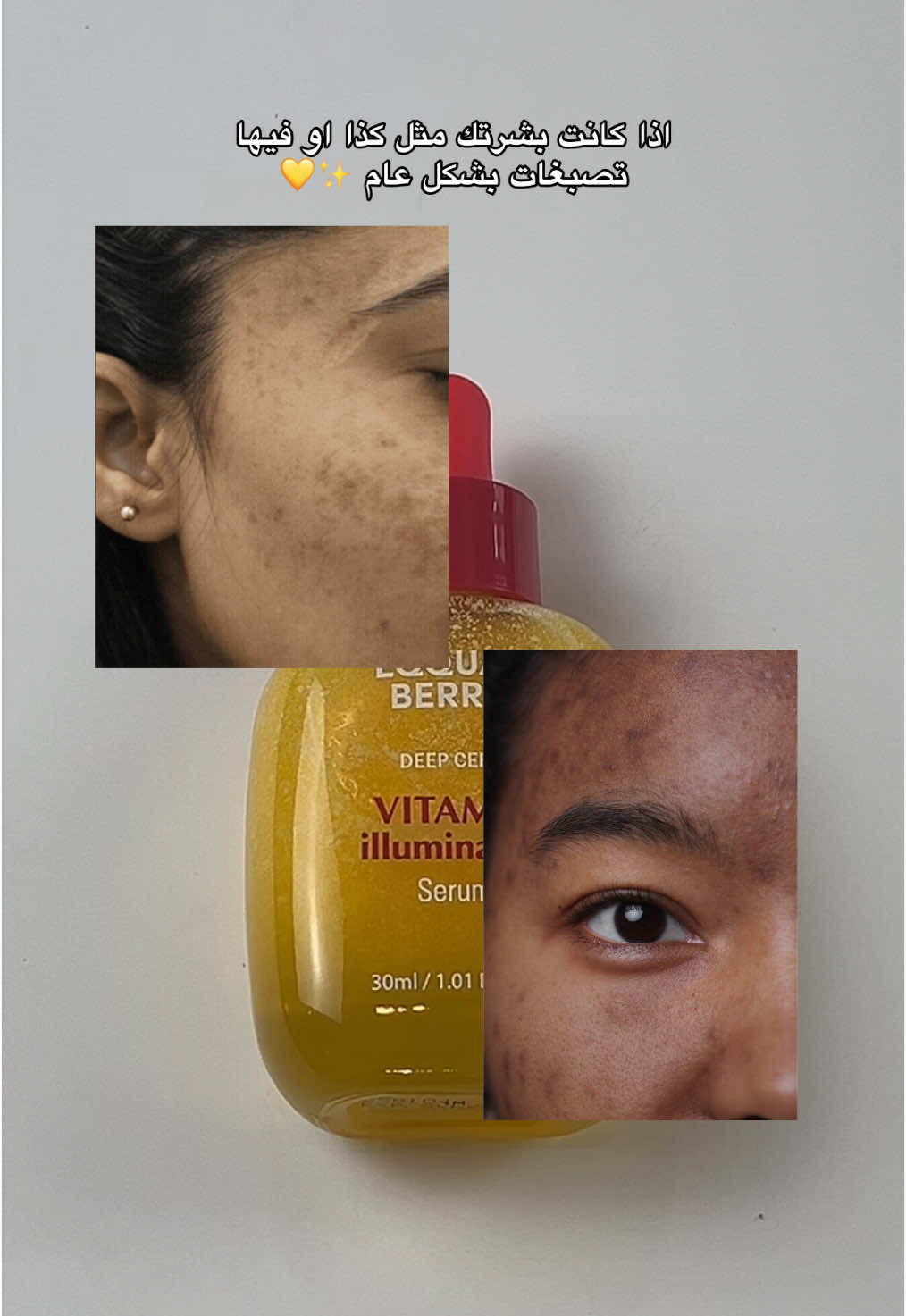 متوفر بمتجرنا ❤️💛#منتجات_كورية #منتجات #عناية_بالبشرة #متجر_كوري #equalberry #عناية_كورية #skincare #skincareroutine #glowingskin #توحيد_لون_البشره #kskincare 