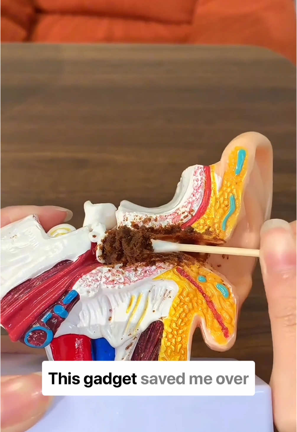 Your cotton buds are LYING to you! 😩 #SmartEarCleaner #EarCare #EarCleaningTool #360EarCleaner #CleanEarsChallenge #GadgetGoals #TiktokMadeMeBuyIt #SelfCareRoutine #EarCleaningSatisfying #SatisfyingVideos #MustHaveGadget #EarCleaningTikTok #ProblemSolved #GadgetLife #AmazonFinds #ShopifyFinds #tiktok #hygiene #health #important #SelfCare #sale #save #viralproducts #shopify #dropshipping 