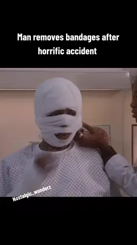Man removes bandages after horrific accident #fyp #nostalgic_wonderz #foryourpage #shortclips #subscibe #fup #fypage 